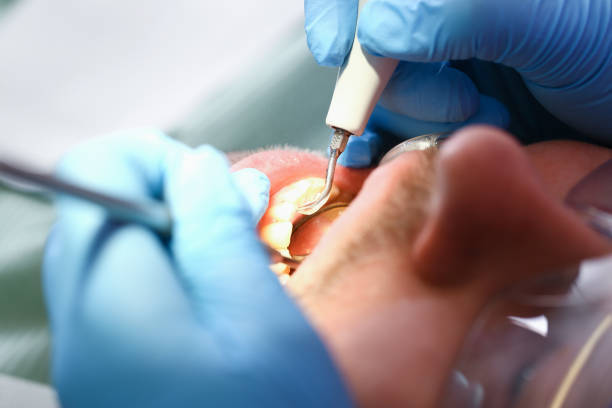 Best Tooth Infection Emergency Dentist  in Camden, OH