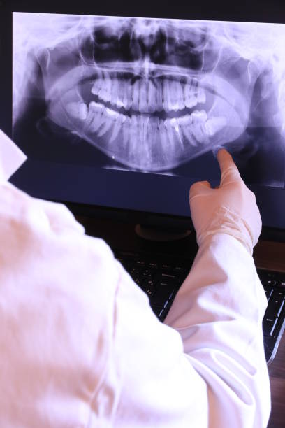 Best Knocked-Out Tooth Emergency  in Camden, OH