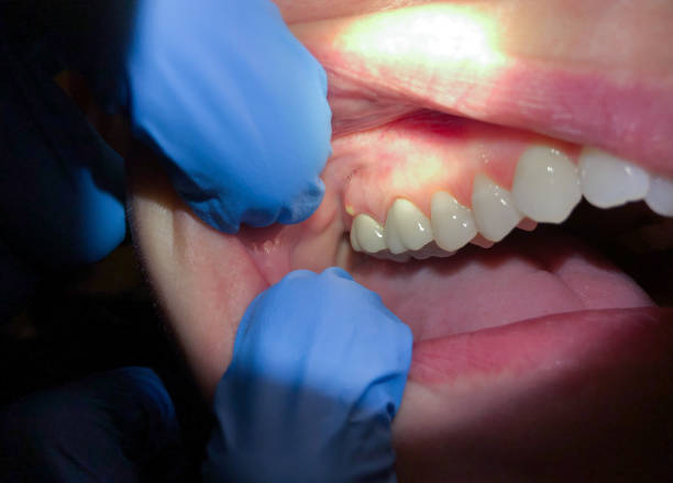 Best Tooth Pain Emergency Relief  in Camden, OH