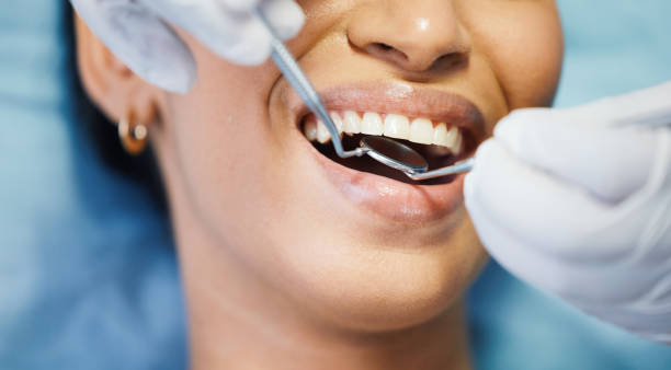 Best Chipped Tooth Repair Near Me  in Camden, OH